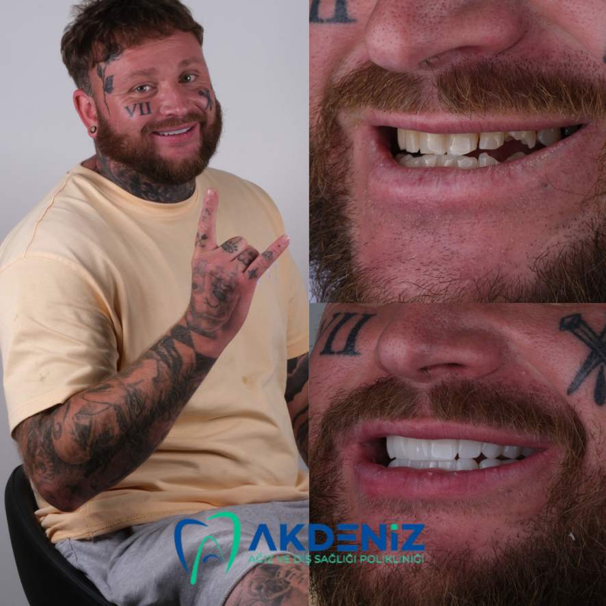 2 (1)